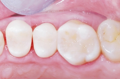Operatoria Dental
