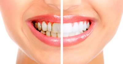 Rehabilitaci&oacute;n Oral