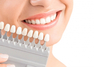 Est&eacute;tica Dental